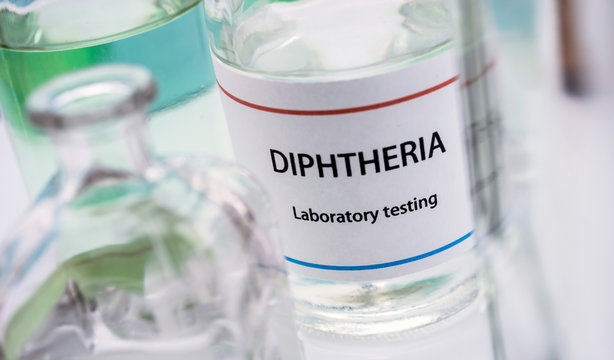 Test diphtheria in laboratory, conceptual image, composition horizontal