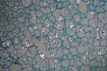 Potato cells with starch corns under the microscope