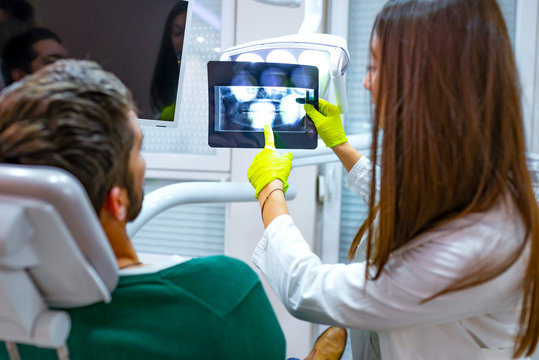 A Dentist Examines Orthopantomogram In Her Hands