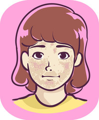 Kid Girl Symptom Brown Patches Illustration