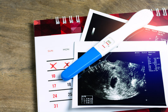 Pregnancy test which results is pregnant and ultrasound film show results is mild baby womb on calendar and woodle table background.