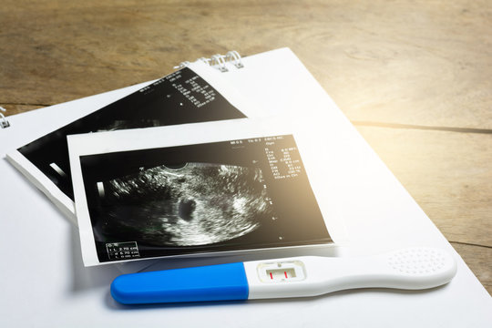Pregnancy test which results is pregnant and ultrasound film show results is mild baby womb on woodle table background.