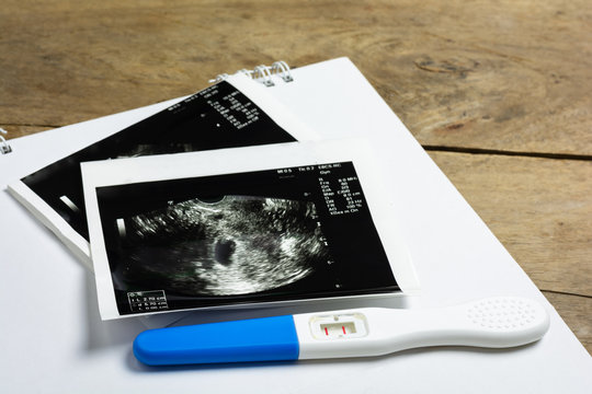 Pregnancy test which results is pregnant and ultrasound film show results is mild baby womb on woodle table background.
