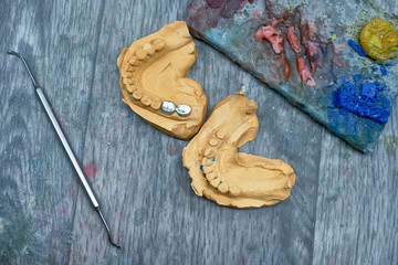 A pair of artificial ceramic dentures on the table