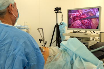Record any video camera and live broadcast of the surgeon. Video image of the internal organs of...