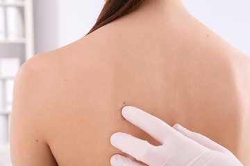 Dermatologist examining patient in clinic, closeup view