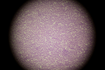 blood smear under microscope
