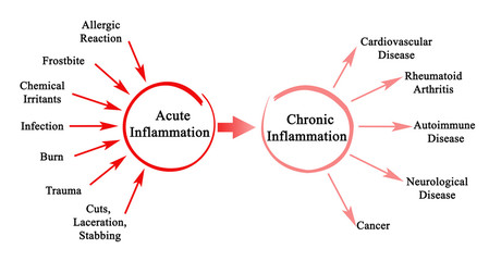 Acute and Chronic  Inflammation - obrazy, fototapety, plakaty