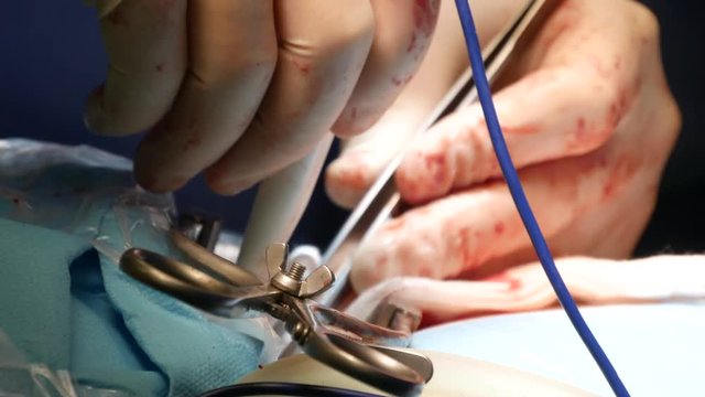 Surgical room in hospital with medical team of surgeons doing minimal invasive surgical interventions. Surgery operating room with electrocautery equipment for cardiovascular emergency surgery center