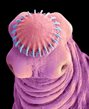 Tapeworm cysticercus, SEM