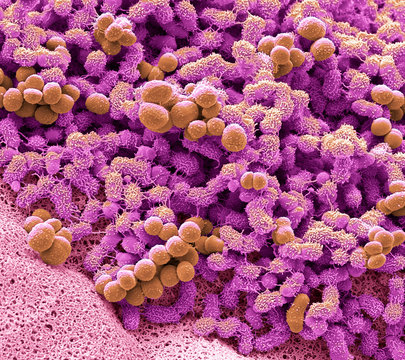 Foot bacteria, SEM