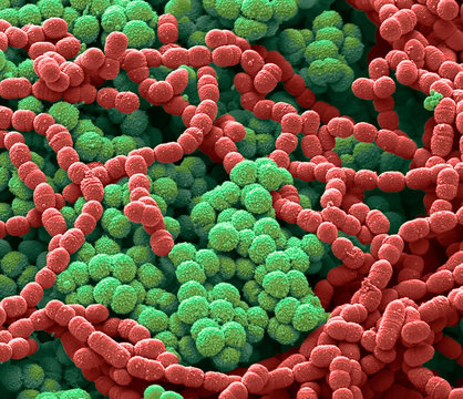 Sputum culture, SEM