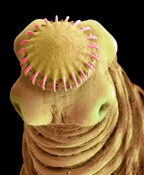 Tapeworm cysticercus, SEM