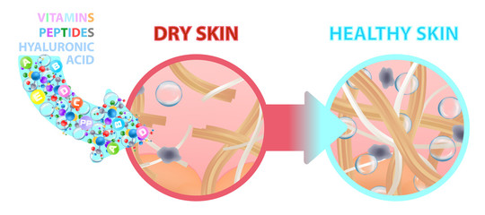 Dry skin enriched with vitamins, nutrition. Healthy skin. Vector illustration