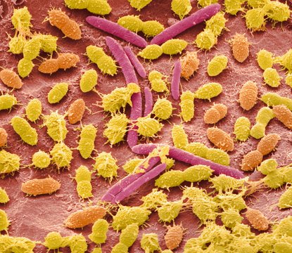 Faecal bacteria, sem