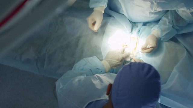 Top view of two surgeons in sanitary clothes and gloves operating on patient at hospital, assistant giving tools to them