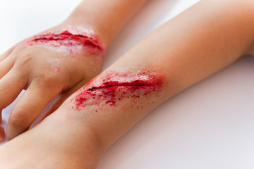 Fake wounds on the arms of children dress the wound special effect