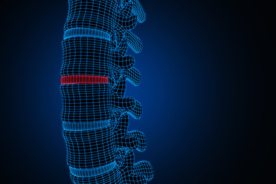 Human spinal system problem concept. Disk spain degradation. Low poly illustration. 3d rendering.