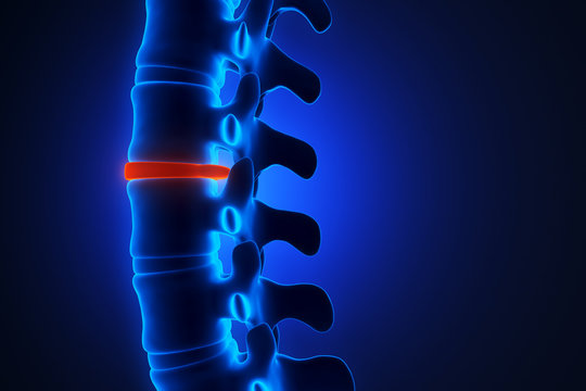 Human spinal system problem concept. Disk spain degradation. X-ray illustration. 3d rendering.