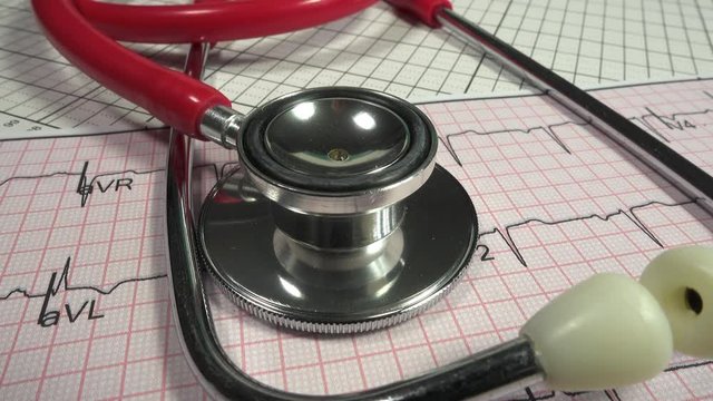 Medical. Track in to a close up of a stethoscope on a ECG graph.