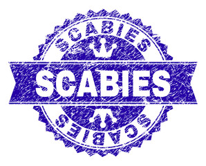 SCABIES rosette seal watermark with grunge effect. Designed with round rosette, ribbon and small crowns. Blue vector rubber watermark of SCABIES caption with grunge style.