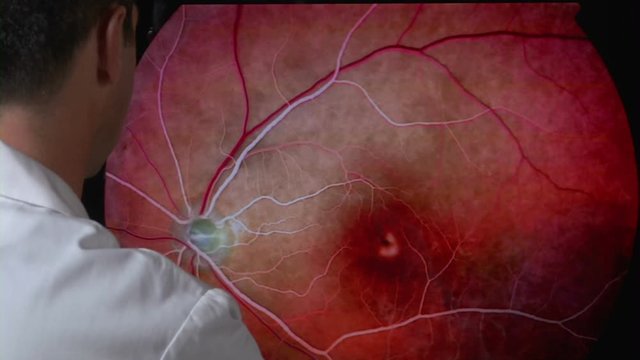 Doctor examining retinal images