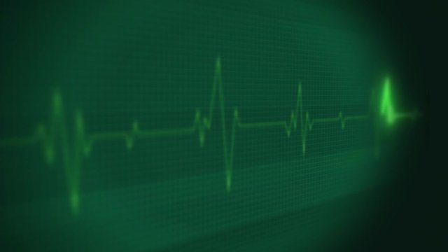 4k Medical Heart Pulsation Wave Signal/ Animation of a health technology background with red sine wave of heart pulsation signal