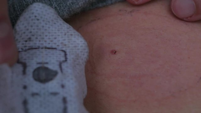 dettaching. removing dexcom transmitter, real-time glucose reading