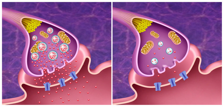 Sinapsis de Dopamina en la enfermedad de Parkinson