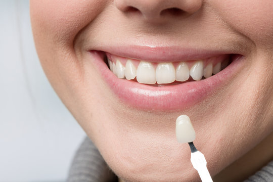 Mund einer jungen Frau mit Zahnfarbprobe