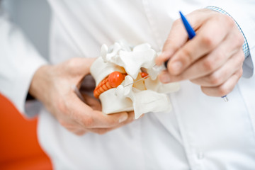 Close-up of therapist holding anatomical model of vertebras with intervertebral hernia