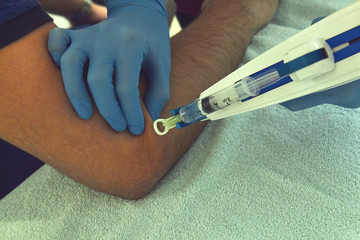 Female doctor doing mesotherapy treatment for pain. Beauty and healthcare.