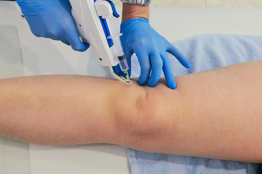 Female doctor doing mesotherapy treatment for pain. Beauty and healthcare.