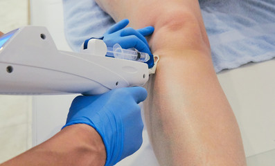 Female doctor doing mesotherapy treatment for pain. Beauty and healthcare.