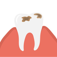 Decay and destroy tooth or dental caries
