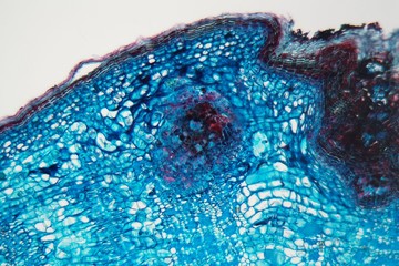 Cells of a plant stem with a disease under a microscope