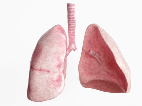 Pneumektomie nach schwerer Lungenerkrankung - 4 von 4 Bildern