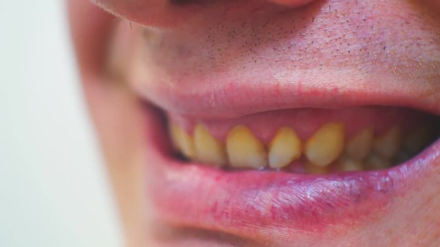 terrible male mouth with yellowed teeth.close-up.macro shooting.shallow depth of field.