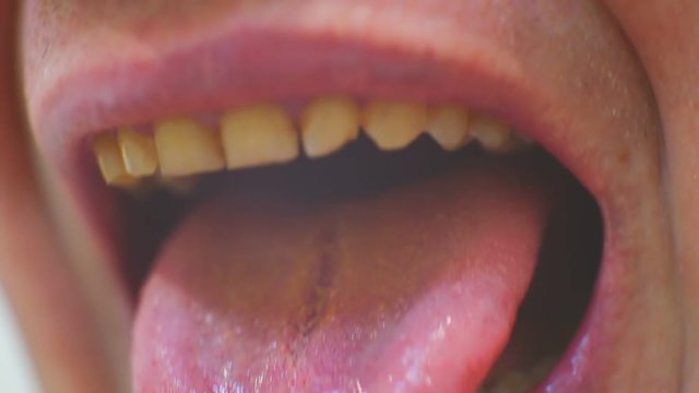 scary male mouth with yellow teeth and tongue closeup