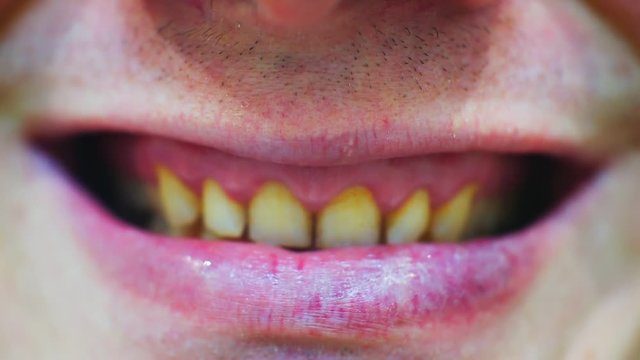 terrible male mouth with yellowed teeth.close-up.macro shooting.shallow depth of field.