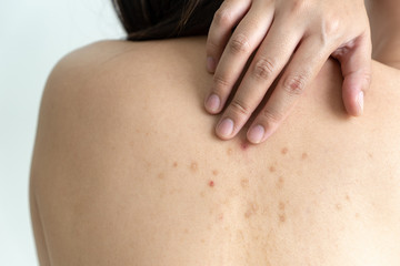 Woman with dermatology skin Dermatologist examining patient