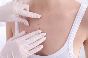 Dermatologist examining patient in clinic, closeup view