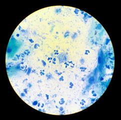 View in the microscope on Trichomonas.