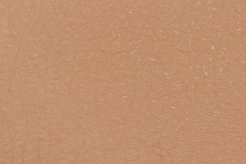 human skin texture macro