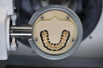 Dental Milling made in the jaw of a polymer
