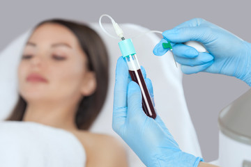 The blood tube is removed to the medical centrifuge for plasma lifting. Prp procedure