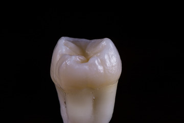 Tooth 28