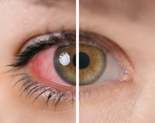 Young woman with beautiful eyes, closeup