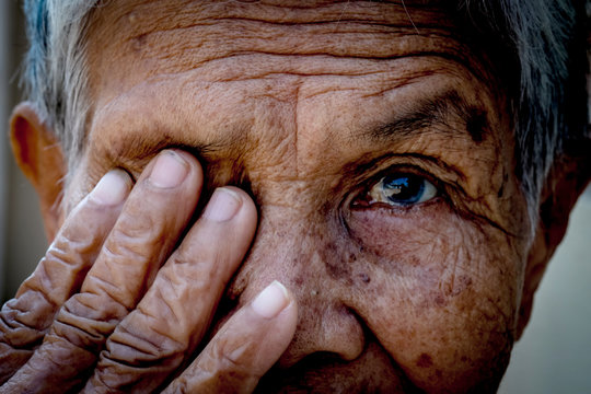 Old Women Cover Her Eye With Her Hand For Eye Testing Use For Medical And Healthcare Background