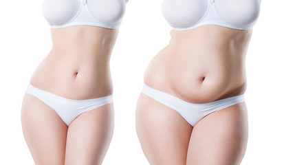 Woman's body before and after weight loss isolated on white background, plastic surgery concept